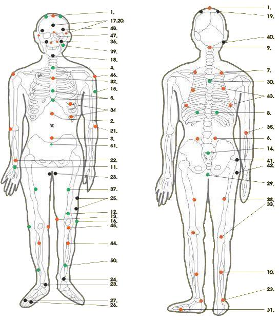 Хиджама точки на теле для лечения с описанием и схемами