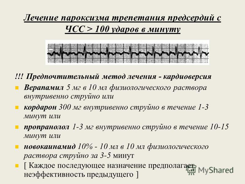 Фибрилляция предсердий что это. Частота сокращений предсердий при трепетании предсердий. Неритмированная форма трепетания предсердий. Пароксизмальная форма трепетания предсердий. Пароксизм трепетания предсердий на ЭКГ.