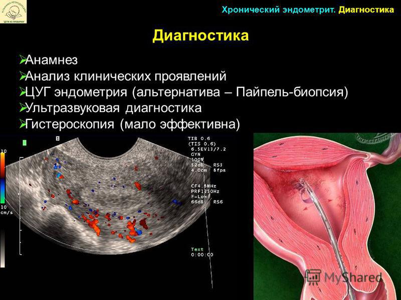 Фото здорового эндометрия