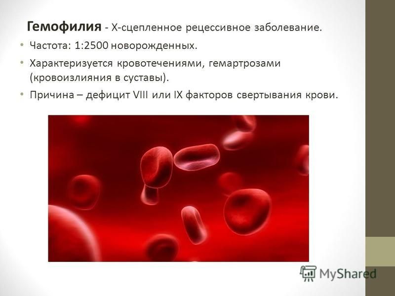 Кровотечение при гемофилии. Х сцепленные заболевания гемофилия
