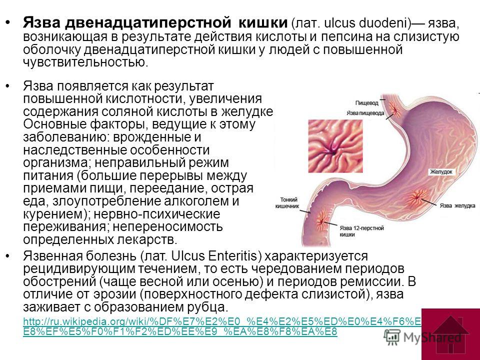 Желудка и 12 перстной. Язва желудка 12 перстной. Причины язвы желудка и 12 перстной. Язва ЖКТ И 12 перстной кишки. Язвенная болезнь 12 перстной кишки причины.