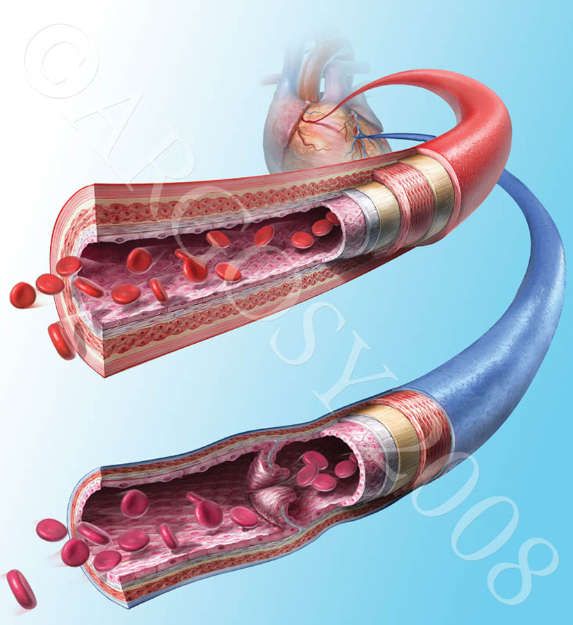Фото сосудов и артерий человека