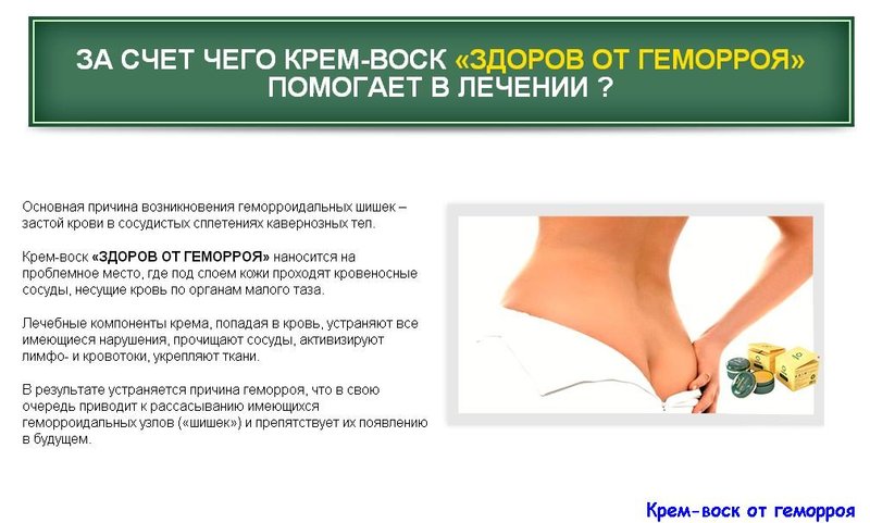 Чем лечить узлы геморроя. Основные причины геморроя у женщин. Узлы геморроя при беременности. Геморрой причины возникновения.