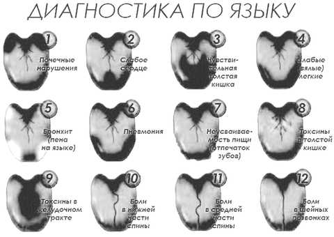 Диагностика по языку в картинках болезней человека цвету