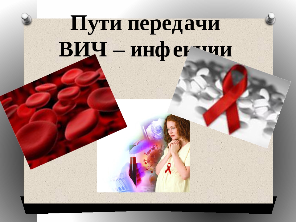 Спид пути передачи. Способы передачи ВИЧ. Пути передачи ВИЧ инфекции. Пути передачи ВИЧ инфекции картинки.