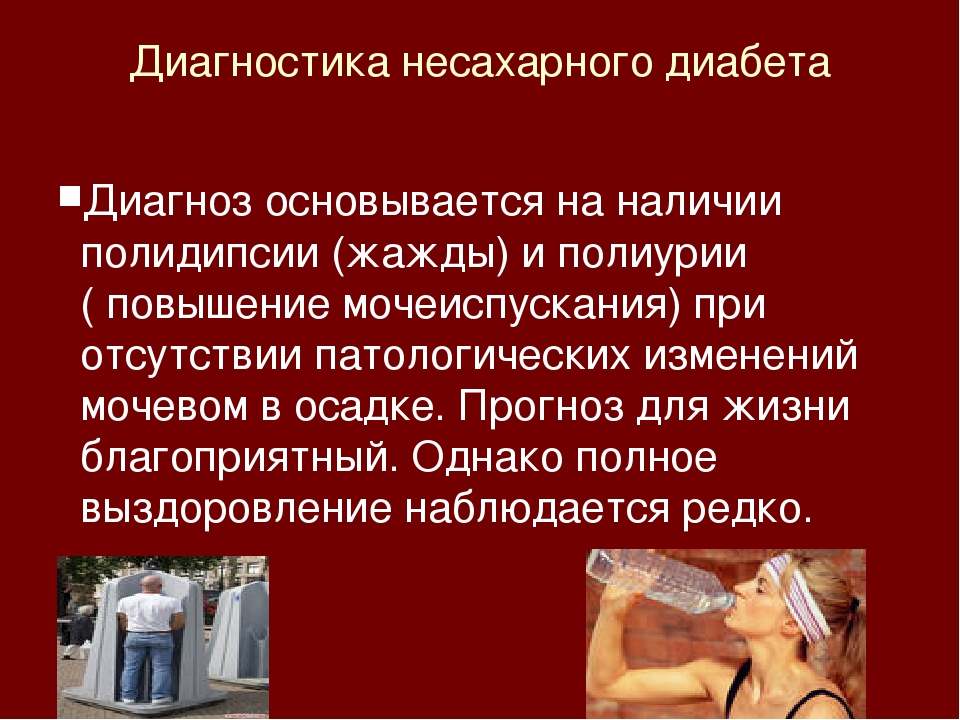 Клиническая картина несахарного диабета