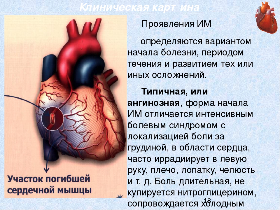 Сердечная область. Локализация сердечных болей. Сердечные боли на схеме. Ангинальные боли в сердце.