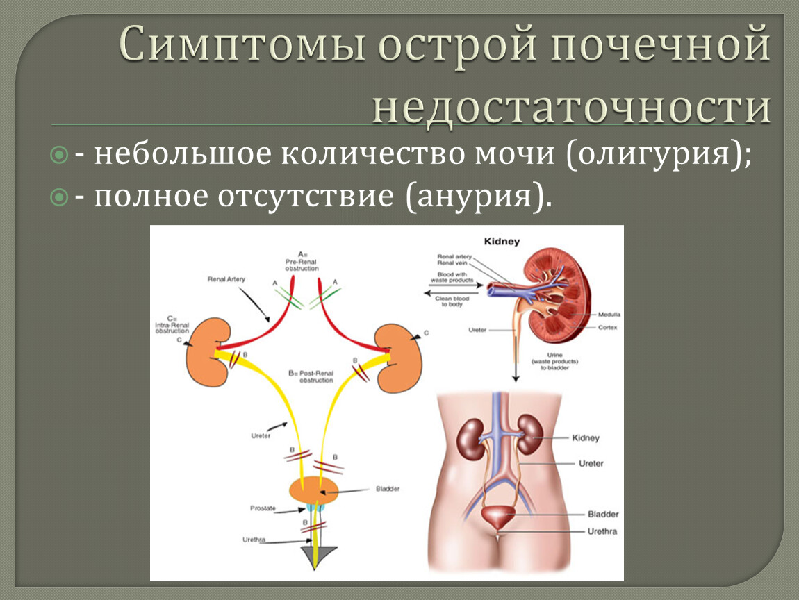 Что такое почечная недостаточность симптомы. Острой почечной недостаточности (ОПН) симптомы.. Острая почечная недостаточность симптомы у мужчин. Острая почечная недостаточность хпн3. Почечная недостаточность почек симптомы.