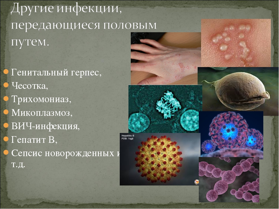 Заболевания передающиеся вирусами. Заболевания кожи инфекции.