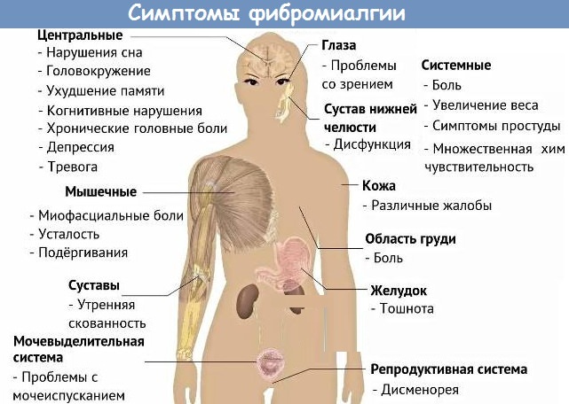 Блуждающая боль по всему телу. Причины в суставах, мышцах