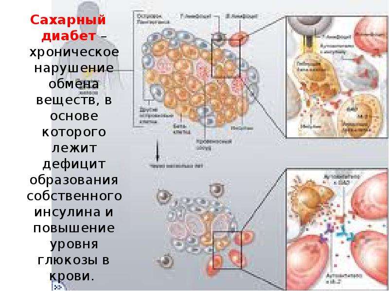 Обмен веществ и диабет