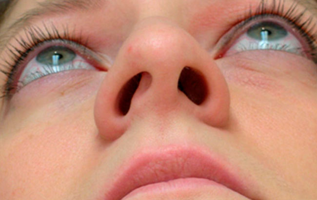 Причины заложенного носа