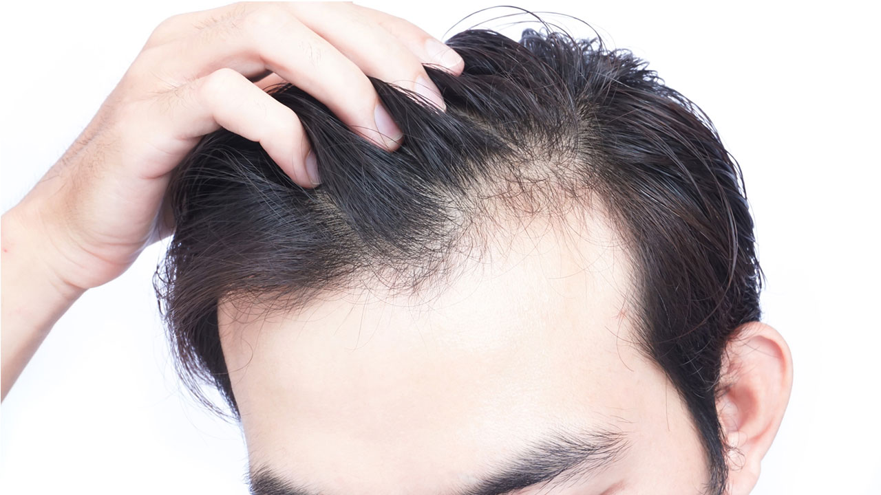 От ношение головного убора могут ли выпадать волосы
