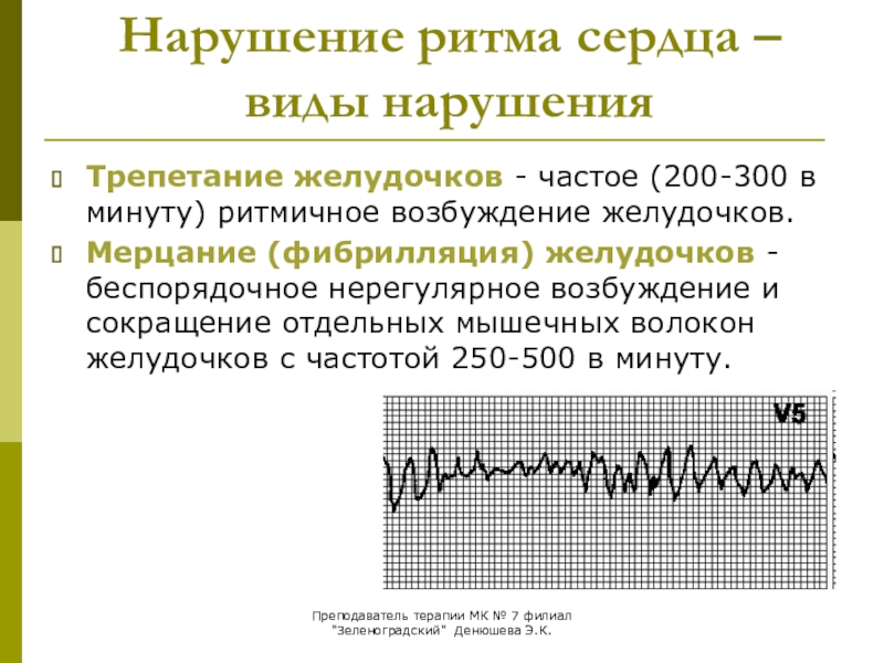 Сердце нарушение