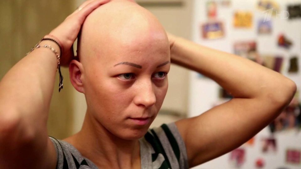 От рака желудка выпадают волосы