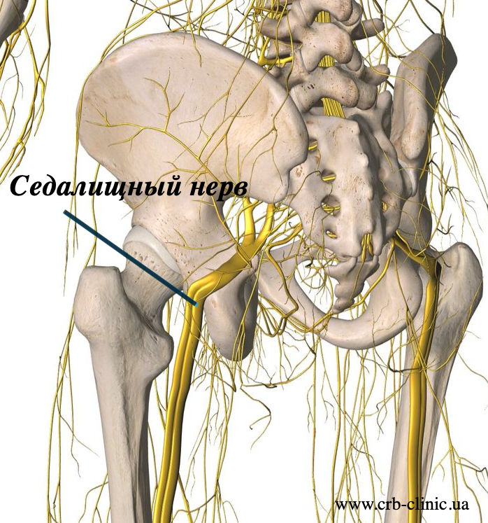 Половой нерв симптомы у женщин. Седалищный нерв. Анатомия тазобедренного сустава седалищного нерва. Бедренный нерв и седалищный нерв. Невропатия седалищного нерва.