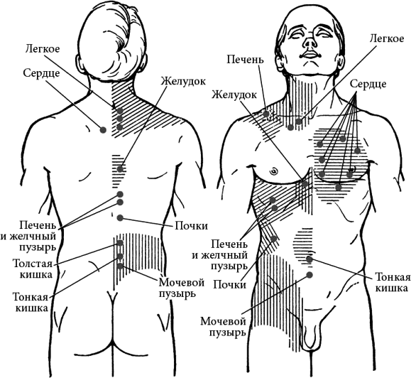 Схема боли в спине