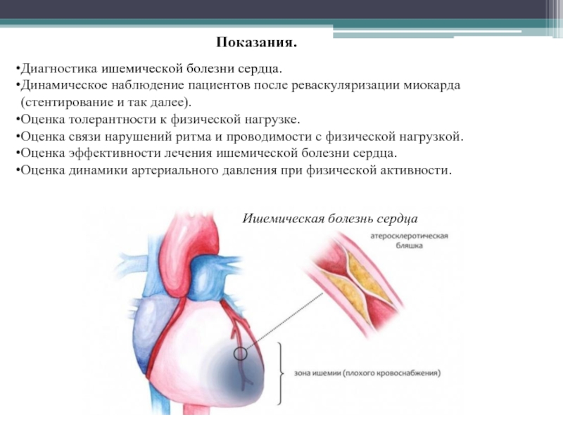 Показания сердечных