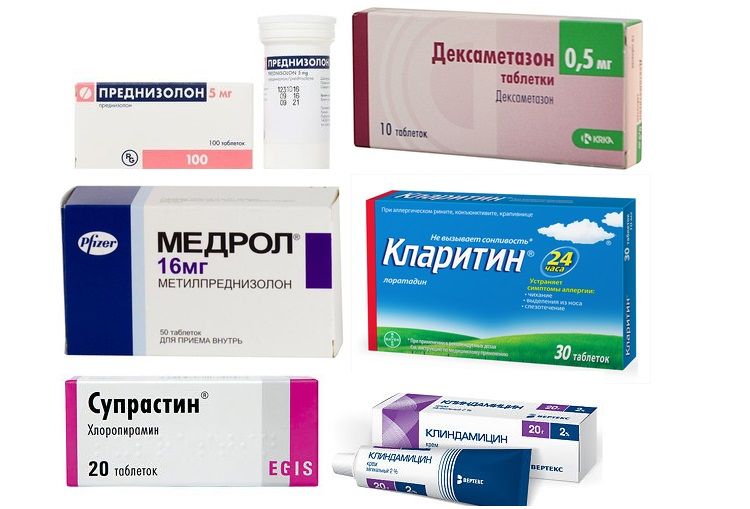 Атопический дерматит лечение у взрослых таблетки