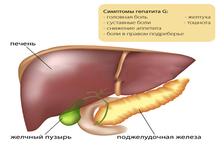 Гепатит желчный пузырь